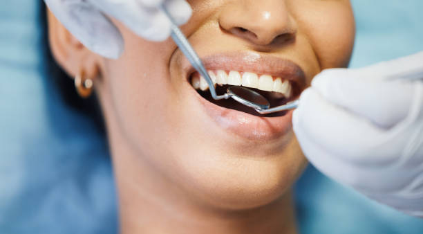 Best Emergency Root Canal Treatment in Jackson, MO